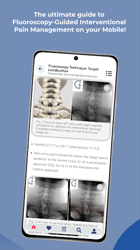 Interventional Pain App Schermafbeelding 4