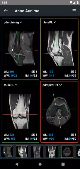 IDV - IMAIOS DICOM Viewer 스크린샷 3