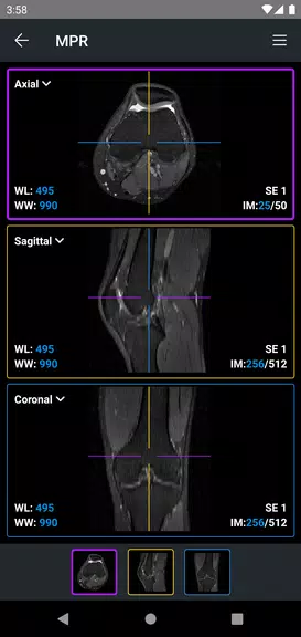 IDV - IMAIOS DICOM Viewer 스크린샷 4