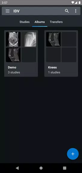 IDV - IMAIOS DICOM Viewer 스크린샷 2