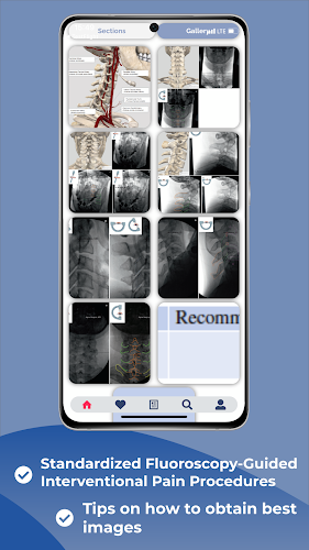 Interventional Pain App應用截圖第3張